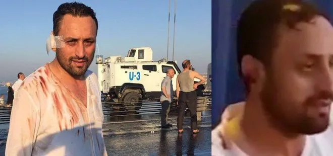 CHP’li İBB 15 Temmuz gazisini mobing uygulayarak istifa ettirdi! AK Parti’den sert tepki geldi: Zulüm var