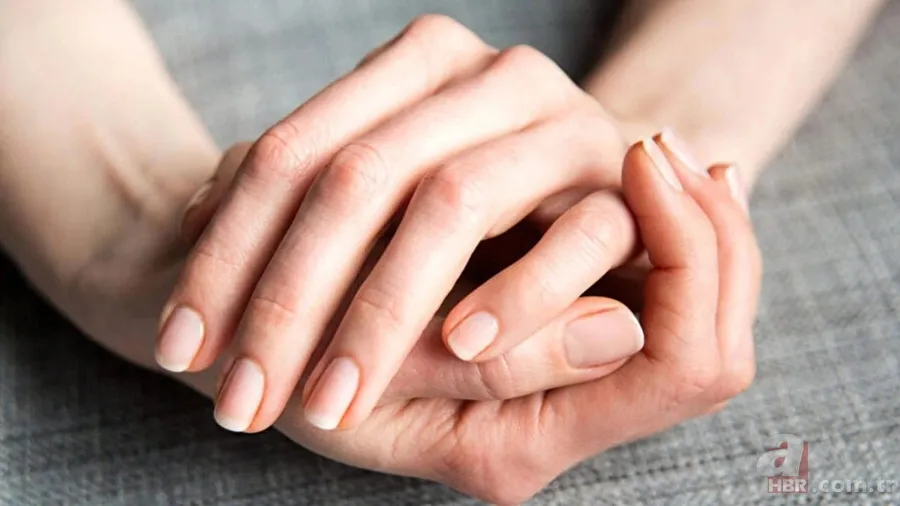 Tırnak diplerinizi kontrol edin! Belki de bu hastalıklardan birine sahipsiniz... 9