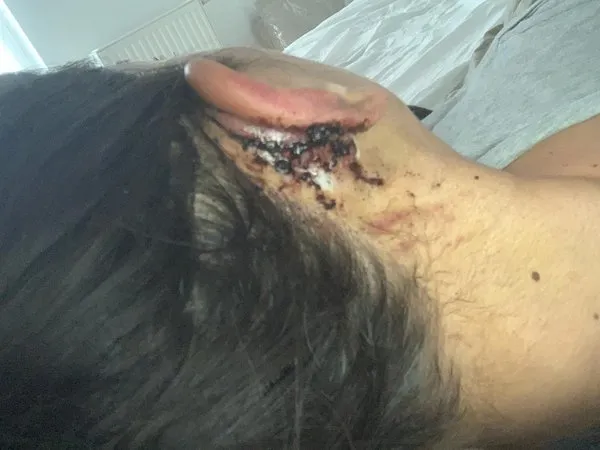 Estetik faciası evlilik arifesindeki kızı hayata küstürdü - 9