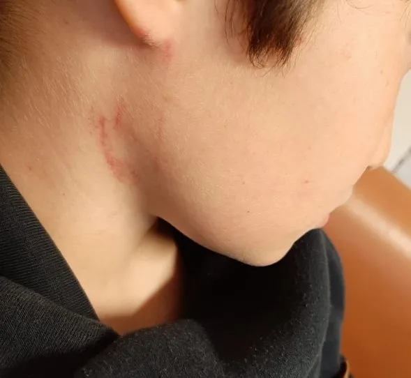 Eskişehir’de öğretmen, 10 yaşındaki öğrencisini yerden yere vurdu - 1