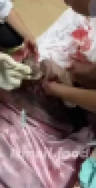 Siyonistlere karşı anne karnında yaşam mücadelesi! Şehit annesinin karnından çıkartıldı