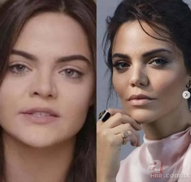 Fotoğrafı şaşkına çevirmişti! Demet Özdemir iddiaları ti’ye aldı! “Bugün estetiği fazla kaçırdım” 21