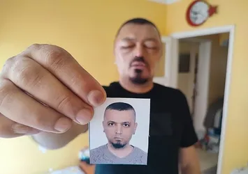 İnternetten aldığı şampuan hayatını kabusa çevirdi! Tanınmaz hale geldi