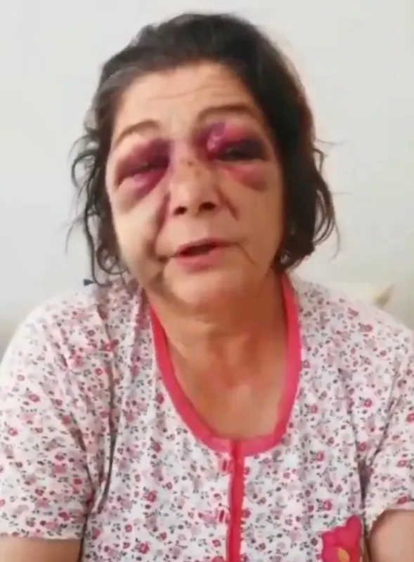 CHP’li Eynesil Belediye Başkanı Ahmet Latif Karadeniz kadına şiddet uygulattı! Sözde aydınlar ve CHP medyasından ses çıkmadı