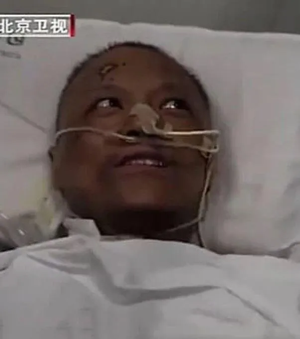 Son dakika: Koronavirüs sonrası ten rengi değişen Çinli doktorun son hali hayrete düşürdü
