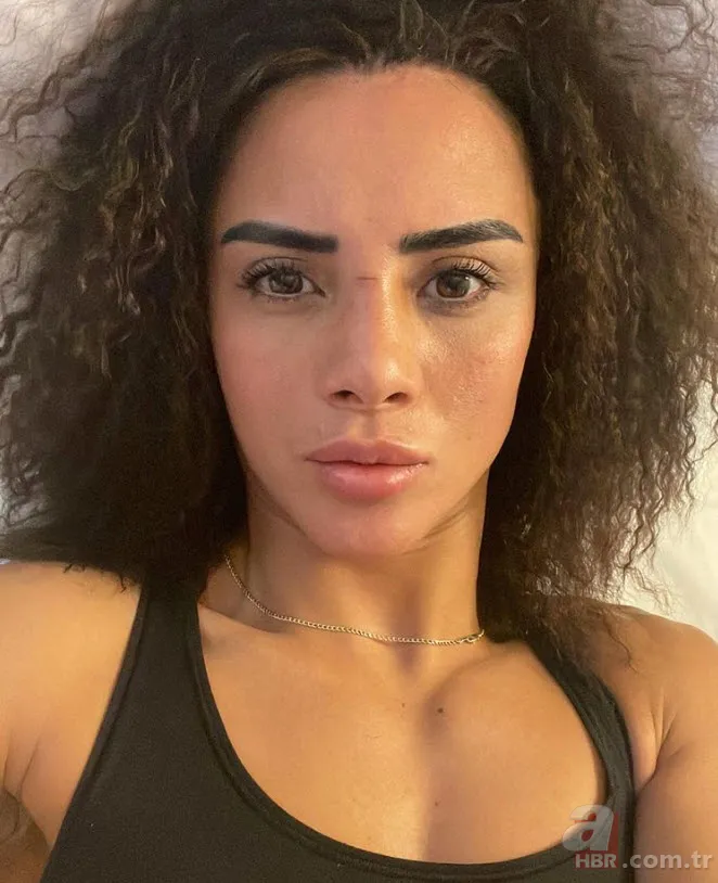 Bir Zamanlar Çukurova’nın Betül’ü İlayda Çevik de estetik harikası çıktı! Eski halini gören tanıyamadı 18