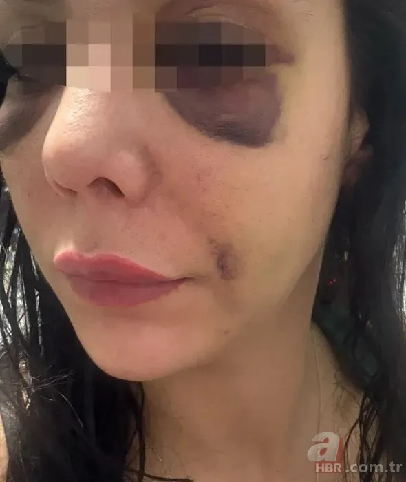 Lisanlı kick boksçudan iş arkadaşına kıskançlık dayağı! 4