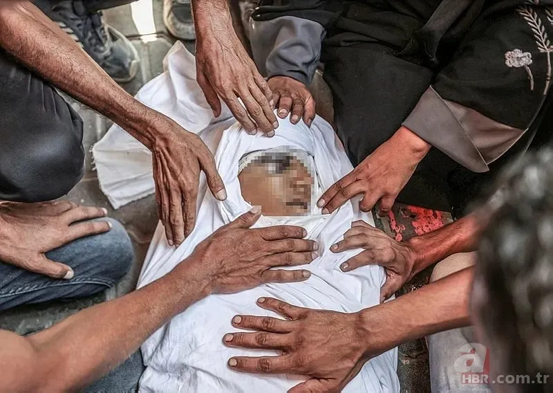 ABD'li doktor soykırımcı İsrail'in acımasızlığını herkese duyurdu: Karnından ve göğsünden vurulmuş çocuklar gördüm 21