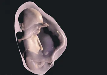 Ultrason yerine 3D gözlük