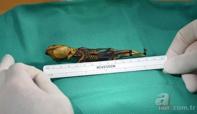 Gizemli iskeletin sırrı çözüldü! Uzaylıya mı ait? UFO teorileri üzerinde duruluyordu… Gerçek bambaşka çıktı 4