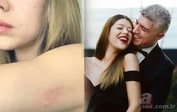 Özcan Deniz'den şiddet mi gördü? Feyza Aktan o fotoğraflara yanıt verdi 1
