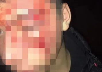 Liseli genci darp edip kayıt altına almışlardı! Görüntüleri çeken öğrenci saldırıya uğradı