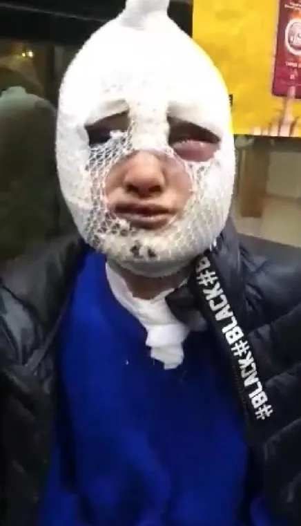 eski-sozlusunu-darp-etti-tecavuz-etti-basindan-asagi-kizgin-yag-doktu-serbest-birakildi-1646830754544.jpg Eski sözlüsünü darp etti, tecavüz etti, başından aşağı kızgın yağ döktü: Serbest bırakıldı - 1