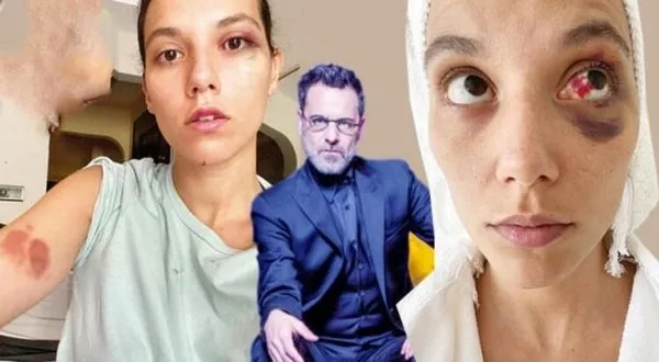 Deniz Bulutsuz’u darp eden Ozan Güven 21 Ocak’ta hesap verecek - 2