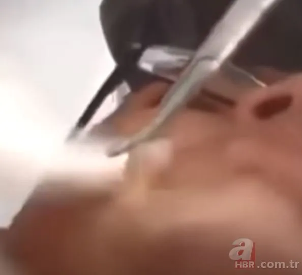 Çenesindeki şişliği sivilce zannetti ama gerçek bambaşka çıktı! Dehşete düşüren olay