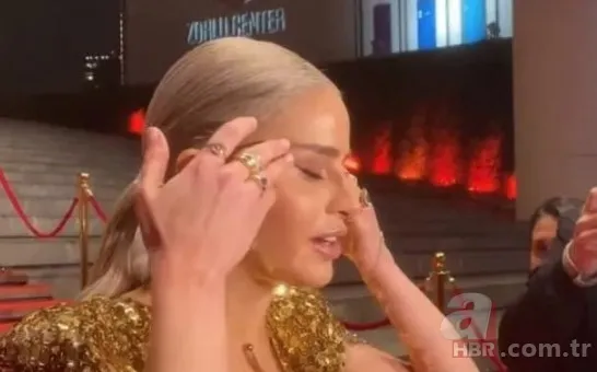 Büşra Pekin’de estetikle yeni birine dönüşenler kervanında! 1 estetiğim var deyince ti’ye alınmıştı… 4 bantla o hale gelmiş! 15