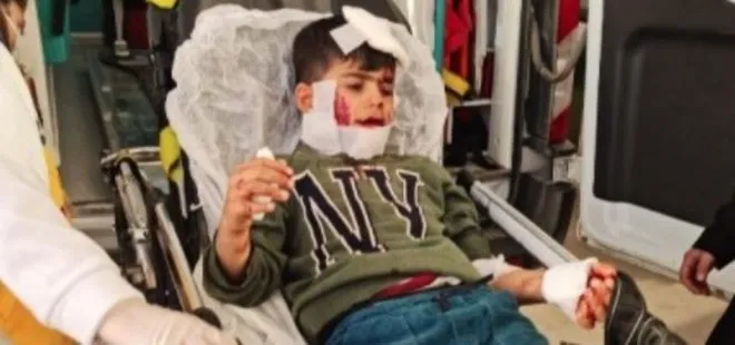 Mardin’de küçük Ahmet uğradığı köpek saldırısı sonucunda ağır yaralandı: Hayati tehlikesi var