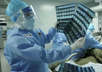 Koronavirüsün bir belirtisi daha ortaya çıktı!