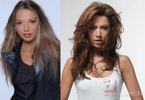 Miray Daner'e ne oldu? Yüzündeki değişim şaşırttı 10