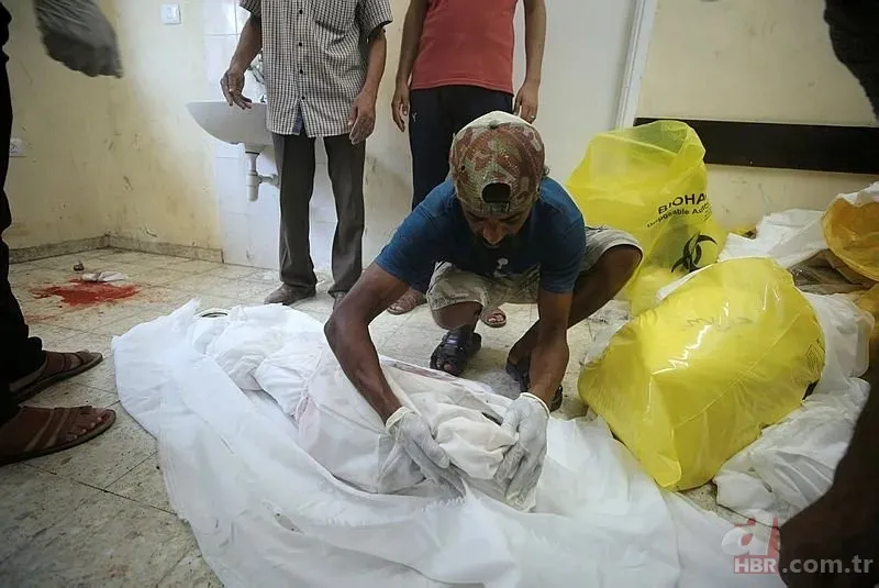 ABD'li doktor soykırımcı İsrail'in acımasızlığını herkese duyurdu: Karnından ve göğsünden vurulmuş çocuklar gördüm 20