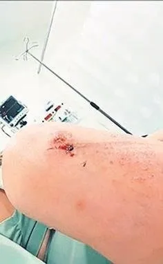 1629785782154.jpeg Çocuğa yardım eden şarkıcı Begüm Polat komşusu tarafından darp edildi - 2