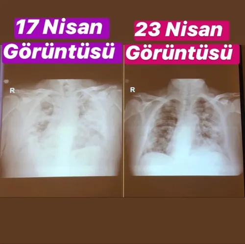 unlu-koronavirus-doktorunun-sevinc-mesaji-1587658799467.jpg Ünlü koronavirüs doktorunun sevinç mesajı - 1