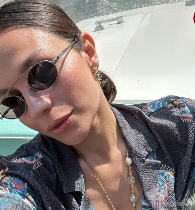 Estetiğin dozunu kaçıran Linet’in son hali şoke etti! “Parayla satın alınan çirkinlik” 11