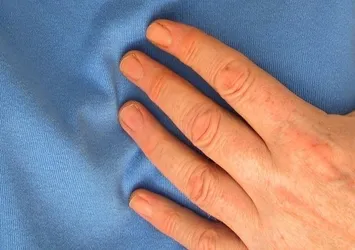 Sıcak havalar ani kalp krizini tetikliyor! Alınması gereken önlemler...