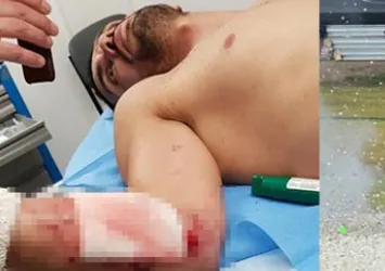 Kenan Sofuoğlu kaza yaptı