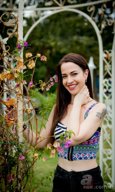 Şarkıcı ve oyuncu Zeynep Doruk dehşeti yaşadı! Köpekler saldırdı: Yüzü tanınmaz hale geldi 5