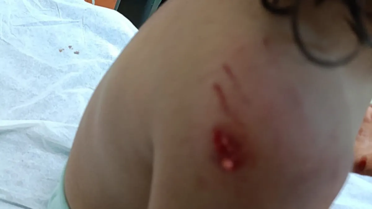 Şanlıurfa'da başıboş köpekler 4 yaşındaki çocuğa saldırdı! Acı içinde hastaneye kaldırıldı...