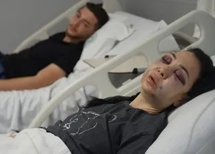 Anne ve oğlunu öldüresiye dövüp ’merdivenden düştü’ dediler: Meğer ilk vukuatları değilmiş