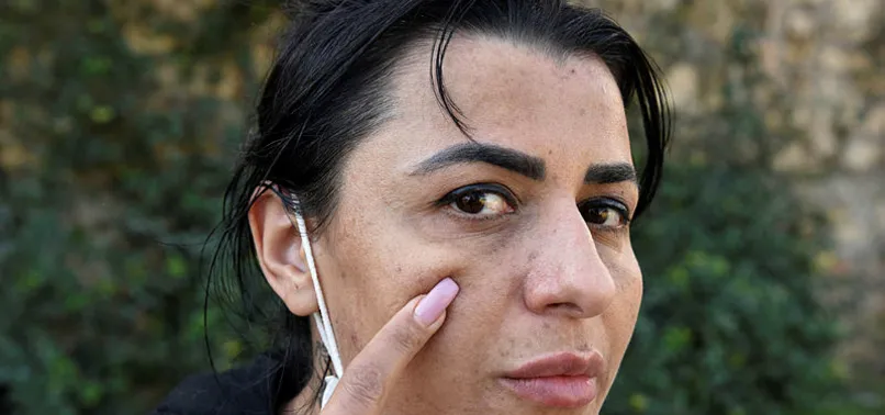 Antalya’da güzellik merkezine giden Aslı İlhan hayatının şokunu yaşadı! Yüzü yandı tehdit edildi