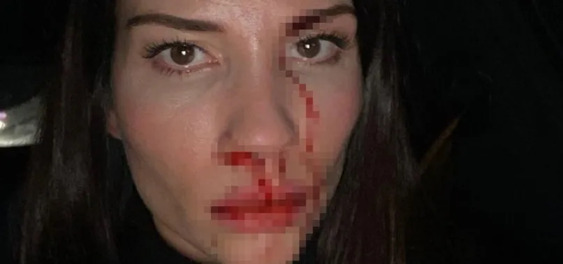 Özer Hurmacı ve Mihriban Hurmacı'nın olaylı davası! İşte hakimin son kararı