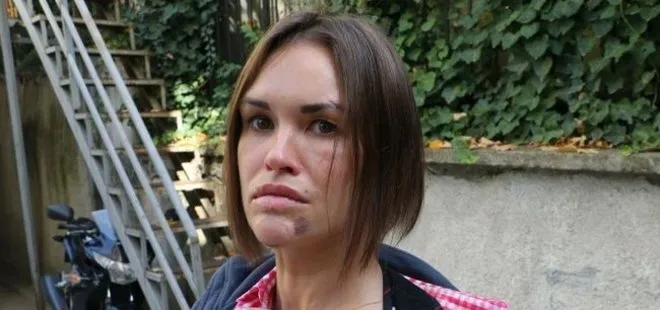Ankara’da lüks sitede ölü bulunan Rus kadının “düşüp öldüğü” şüphesi üzerinde duruluyor