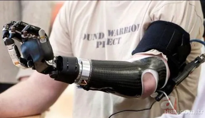 Oyuncu olmak uğruna kolunu kesti "Savaş gazisiyim" dedi 4