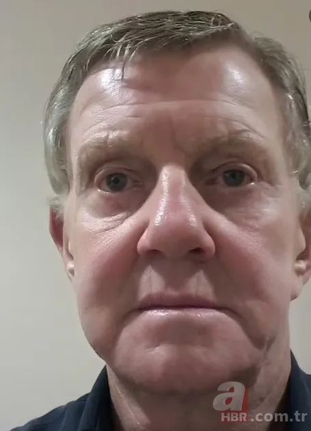 3 senedir gözlerini kapatamıyor! Sağlığına kavuşmak için Türkiye’ye geldi 3