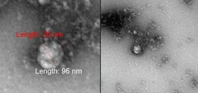 Son dakika: Dünyayı heyecanlandıran kare! İşte mutasyonlu koronavirüsün ilk fotoğrafı | Rus bilim insanları duyurdu
