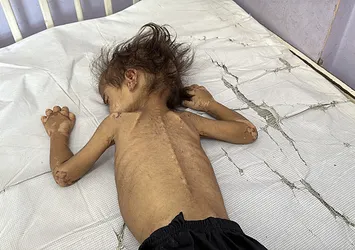 İsrail 24 saatte 5 Filistinliyi daha açlıkla katletti