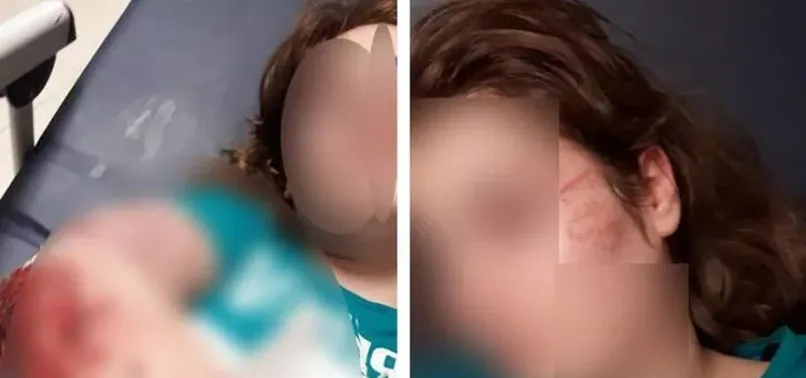 Ağabeyinin darp ettiği üniversiteli Ceylan, kendini ikinci kattan attı