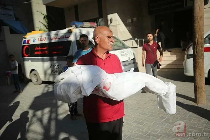 ABD'li doktor soykırımcı İsrail'in acımasızlığını herkese duyurdu: Karnından ve göğsünden vurulmuş çocuklar gördüm 19