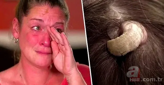 Bilim insanları şaşkın! Kafasında boynuz çıktı... 1