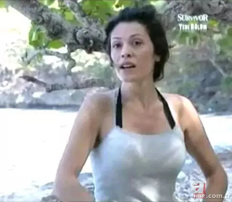 Yüz nakli sonrası ilginç gelişme! Didem Ceran'ın kaşında saç çıktı 2