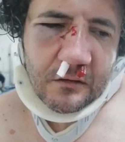 1661229700056.jpg Nafakayı alamadığını iddia eden öfkeli kadın dehşet saçı: Eski kocaya kayınbirader dayağı! - 3