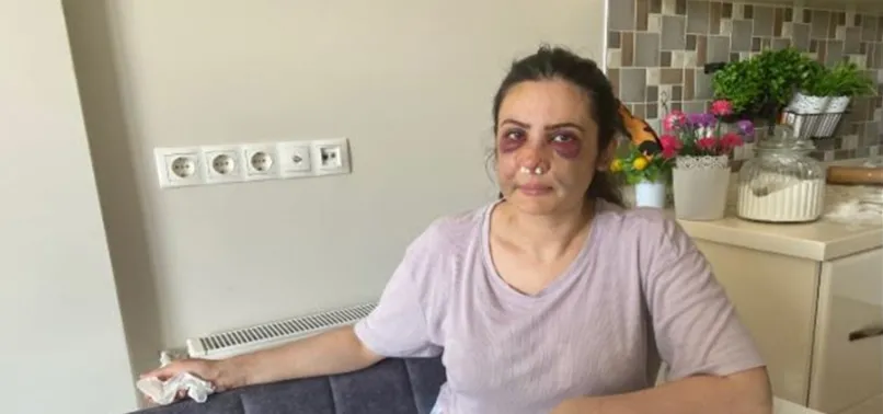 Derya Elbasan son anda kurtuldu! Kızı Twitter'da yardım istedi...