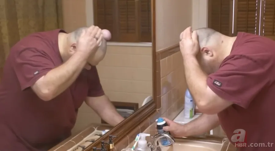 Sokağa şapka ile çıkıyordu! Başındaki şişlikten bakın ne çıktı 👩⚕️ Görenleri şaşkına çeviren olay 17