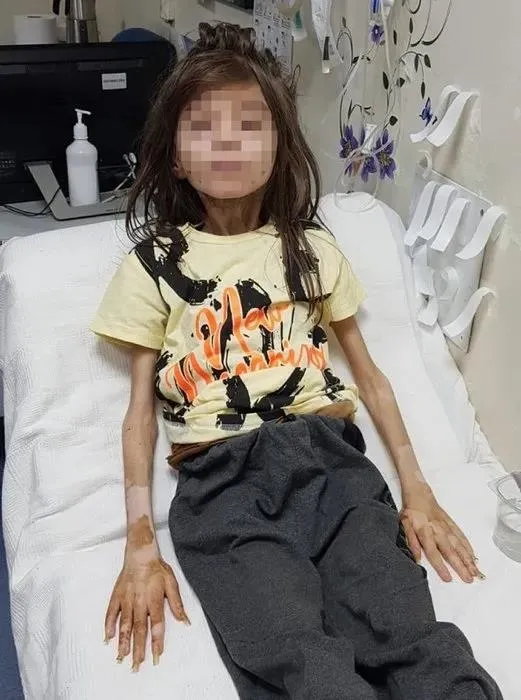 1700384875409.jpeg Çöp evde bulunan Cem Muhammet için önemli karar! İşte Cem Muhammet’in son hali - 5