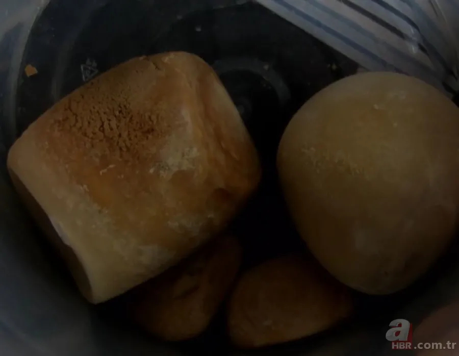 Karın bölgesinde şişlik ve halsizlik şikayetiyle doktora gitti! Karnından çıkanlar şoke etti 12