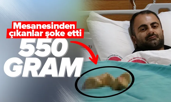 Mesanesinden çıkanlar şoke etti