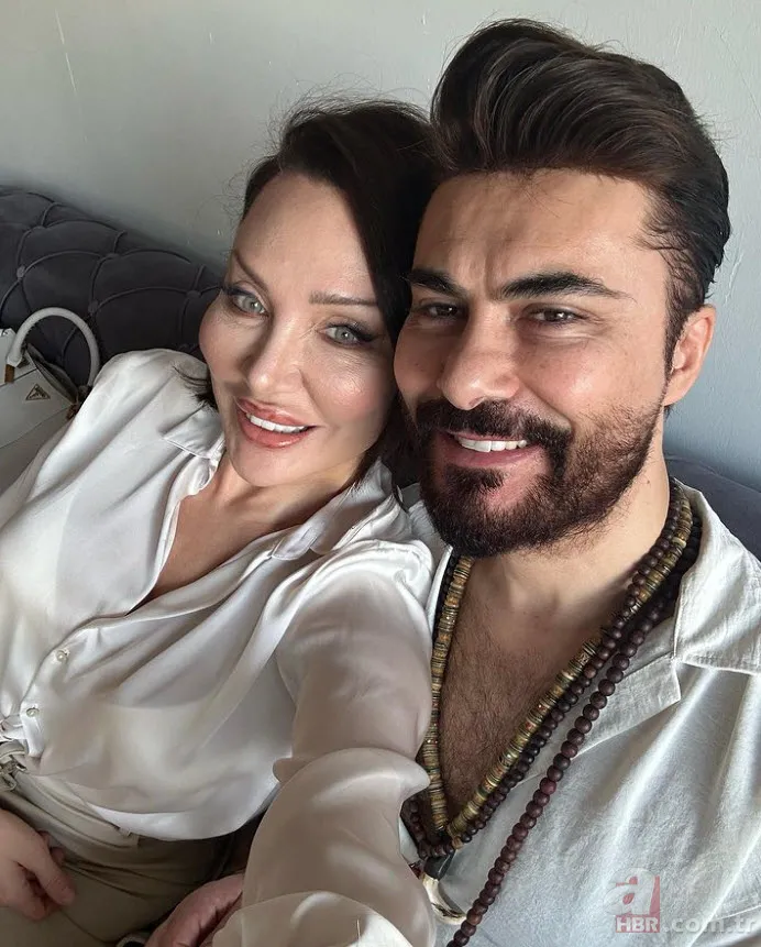 Böylesi görülmedi! Umut Akyürek bakın neresine estetik yaptırdı 2